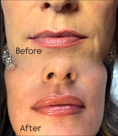 Lip blush Vero Beach — soft rosy permanent lip color