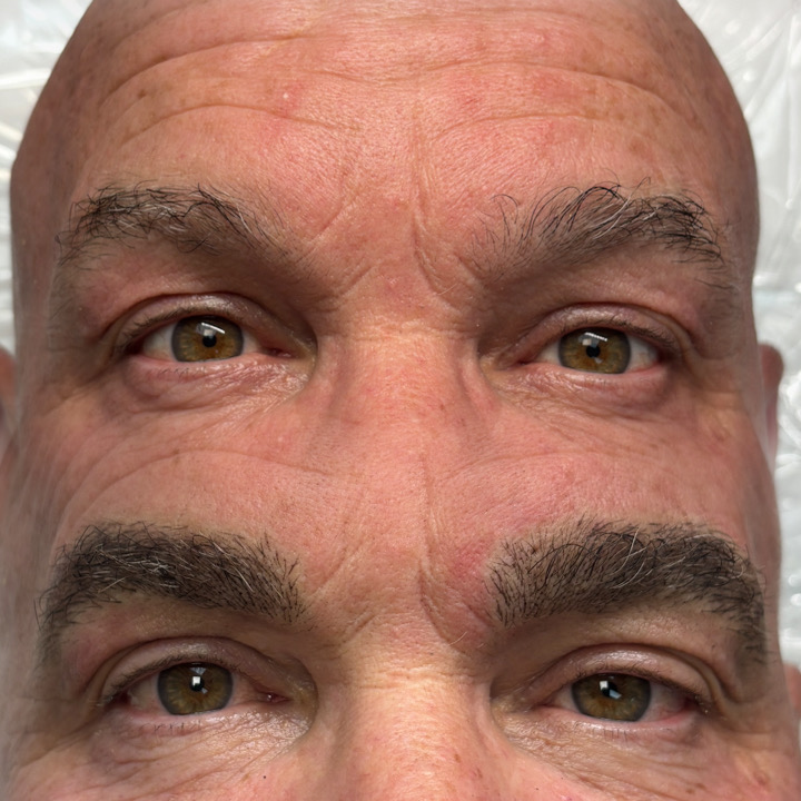 Men's permanent brow enhancement result