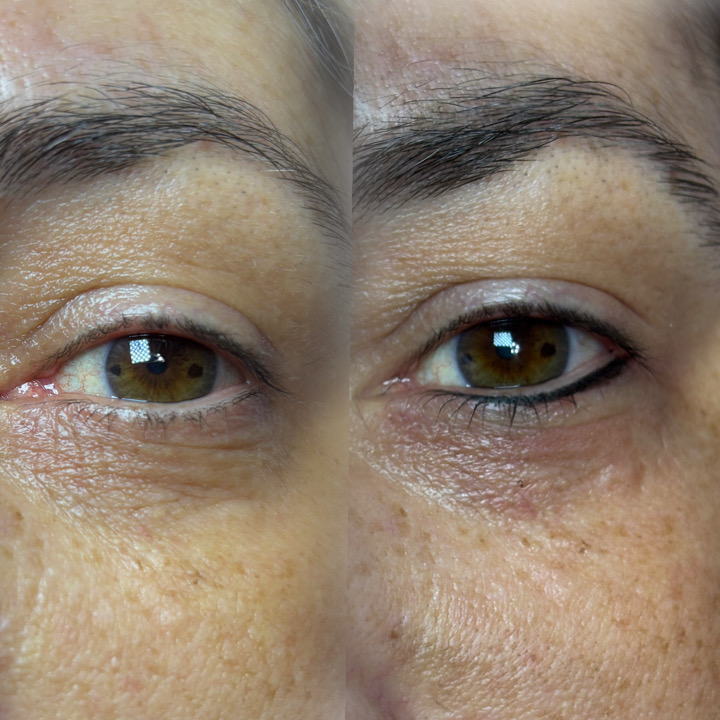 Permanent eyeliner before and after close-up